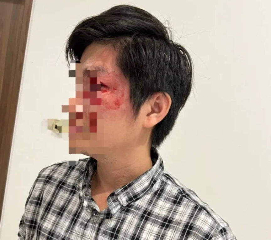 Vụ chủ chú chó đấm người đàn ông bảo vệ con: Người phụ nữ đi cùng chủ chú chó buông lời thách thức-2