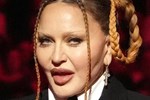 Nhan sắc nữ hoàng nhạc pop Madonna gây sốc, fan kêu gọi ngừng phẫu thuật thẩm mỹ