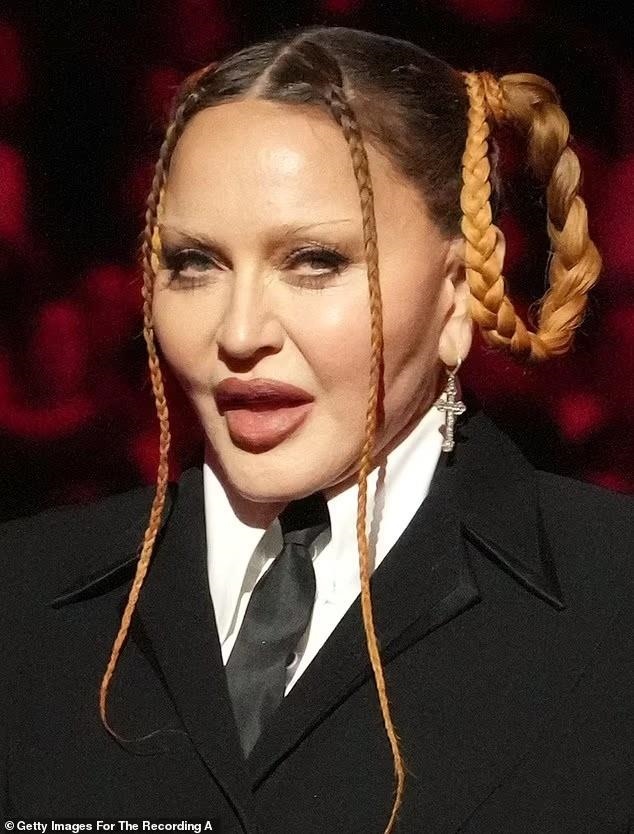 Nhan sắc nữ hoàng nhạc pop Madonna gây sốc, fan kêu gọi ngừng phẫu thuật thẩm mỹ-2