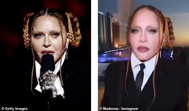 Nhan sắc nữ hoàng nhạc pop Madonna gây sốc, fan kêu gọi ngừng phẫu thuật thẩm mỹ-3