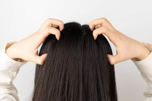 Bí quyết chăm sóc da dầu khi thời tiết nồm ẩm-1