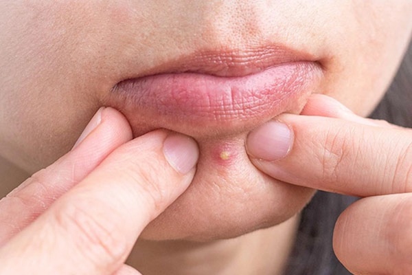 4 dấu hiệu trên khuôn mặt cảnh báo tử cung suy yếu, mắc bệnh nhưng dễ bị bỏ qua-2