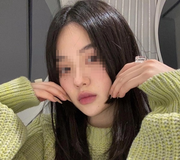 4 dấu hiệu trên khuôn mặt cảnh báo tử cung suy yếu, mắc bệnh nhưng dễ bị bỏ qua-3