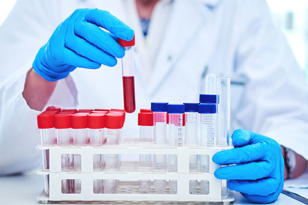 Sự cô đơn ảnh hưởng đến tim và nguy cơ đột quỵ gây tử vong như thế nào?-2