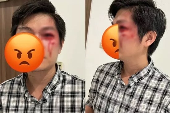 Người bố bị chủ chó đánh vỡ răng quyết không đồng ý hòa giải