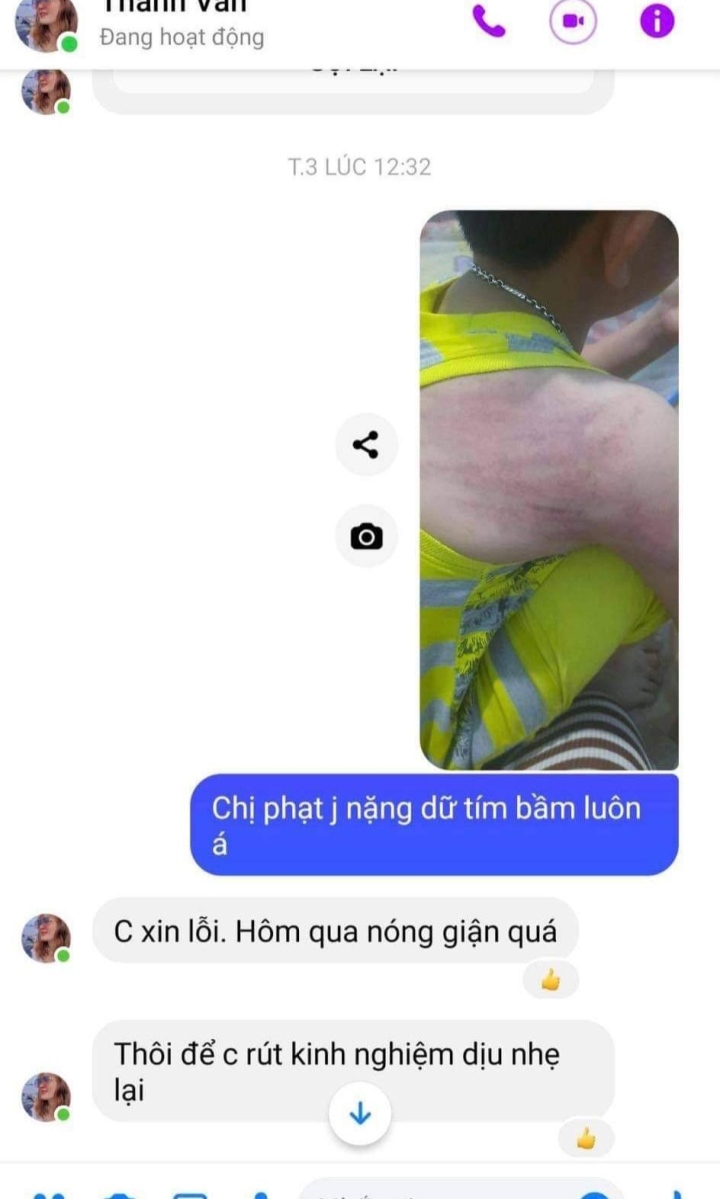 Phú Yên: Người dạy học thêm tại nhà đánh học sinh lớp 5 bầm tím lưng-2