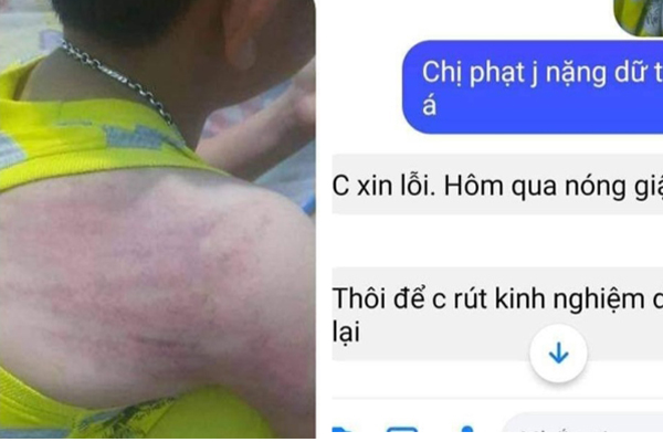Giáo viên dùng thước nhôm gõ bôm bốp vào đầu trẻ-2