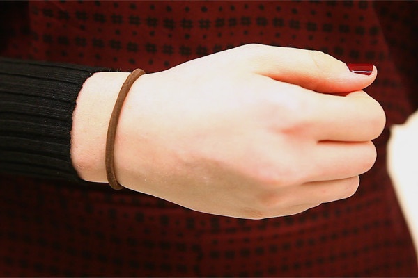 Người phụ nữ mắc bệnh đe dọa tính mạng do chiếc dây buộc tóc-1