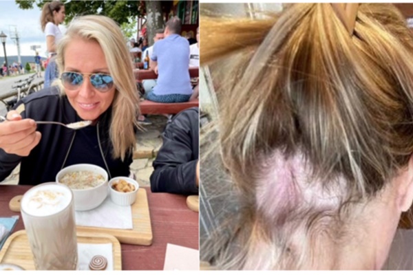 Sản phẩm chăm sóc tóc của Olaplex bị nghi gây hói, tổn thương da đầu-2