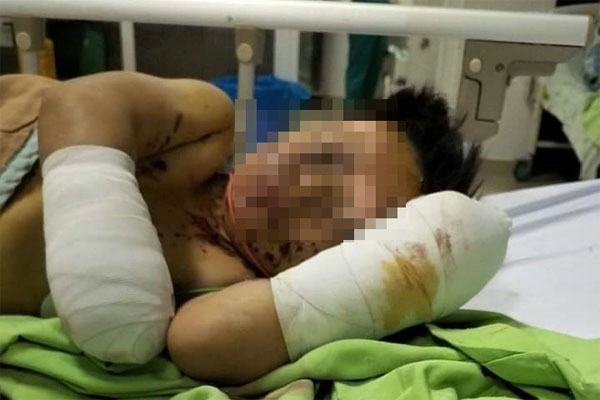 Clip: Rò rỉ khí gas, nhà hàng phát nổ kinh hoàng-1