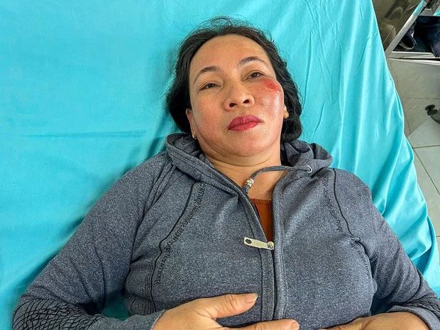 Nữ nạn nhân vụ tai nạn ở Quảng Nam bàng hoàng kể lại khoảnh khắc thoát chết-2