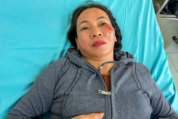 Tai nạn thương tâm ở Bình Dương, người phụ nữ đi cùng thất thần-2