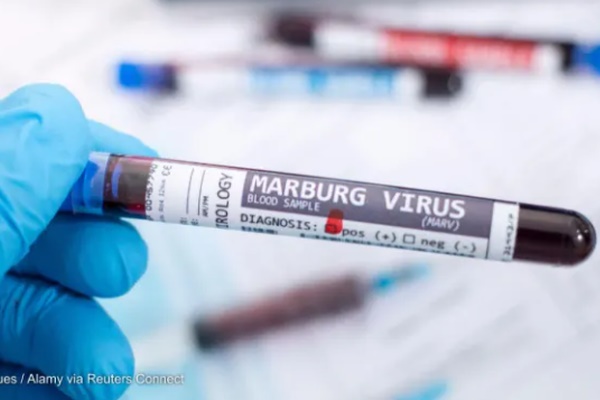 WHO họp khẩn vì ổ dịch sốt xuất huyết do virus Marburg-1