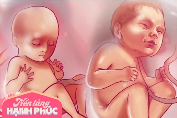 Từ học sinh giỏi cấp quốc gia, nam sinh bỗng mắc bệnh trầm cảm, bất mãn với bố mẹ vì lý do này!-3