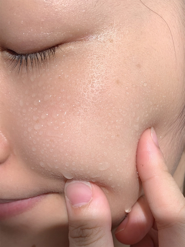 Chuyên gia da liễu chỉ rõ sản phẩm cần dùng để cải thiện 3 kiểu lỗ chân lông to phát sinh khi da lão hóa-5