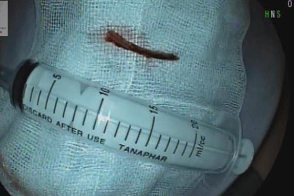 Mời thầy cúng làm phép chữa hóc xương gà-1