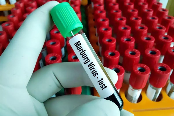 Virus khiến 9 người tử vong sau đám tang có khả năng lây sang Việt Nam?-1