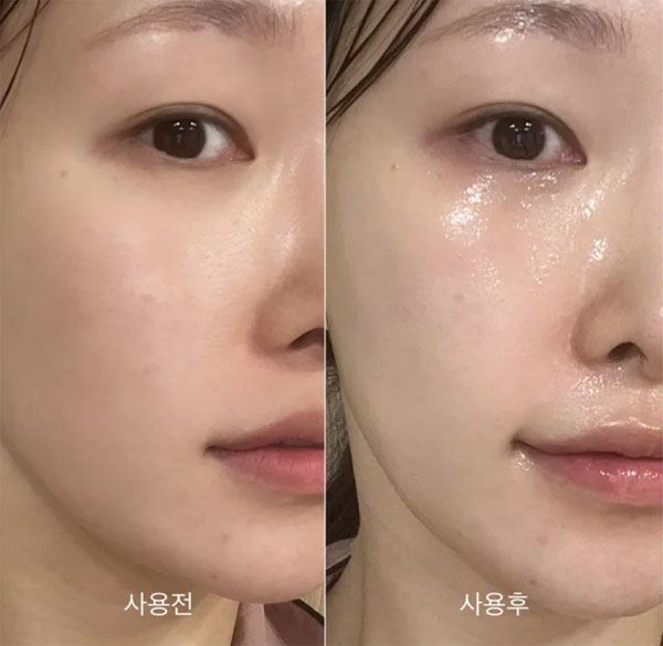 Thời điểm dùng serum phát huy tối đa hiệu quả cho da mụn, da dầu, da lão hóa-4