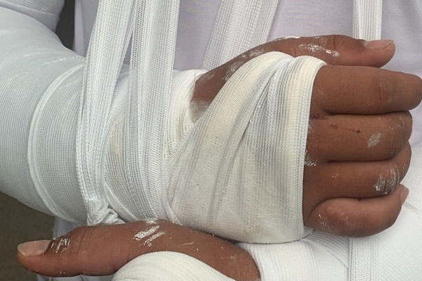 Gia cảnh éo le của shipper bị người vác tuýp sắt đánh gãy 2 tay-1