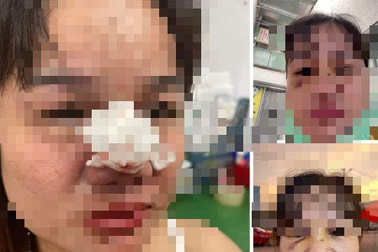 Người nổi tiếng kêu gọi từ thiện ở Quảng Nam bị 