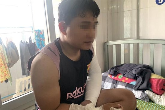 Shipper bị đánh khi giao hàng phải mổ cả 2 tay