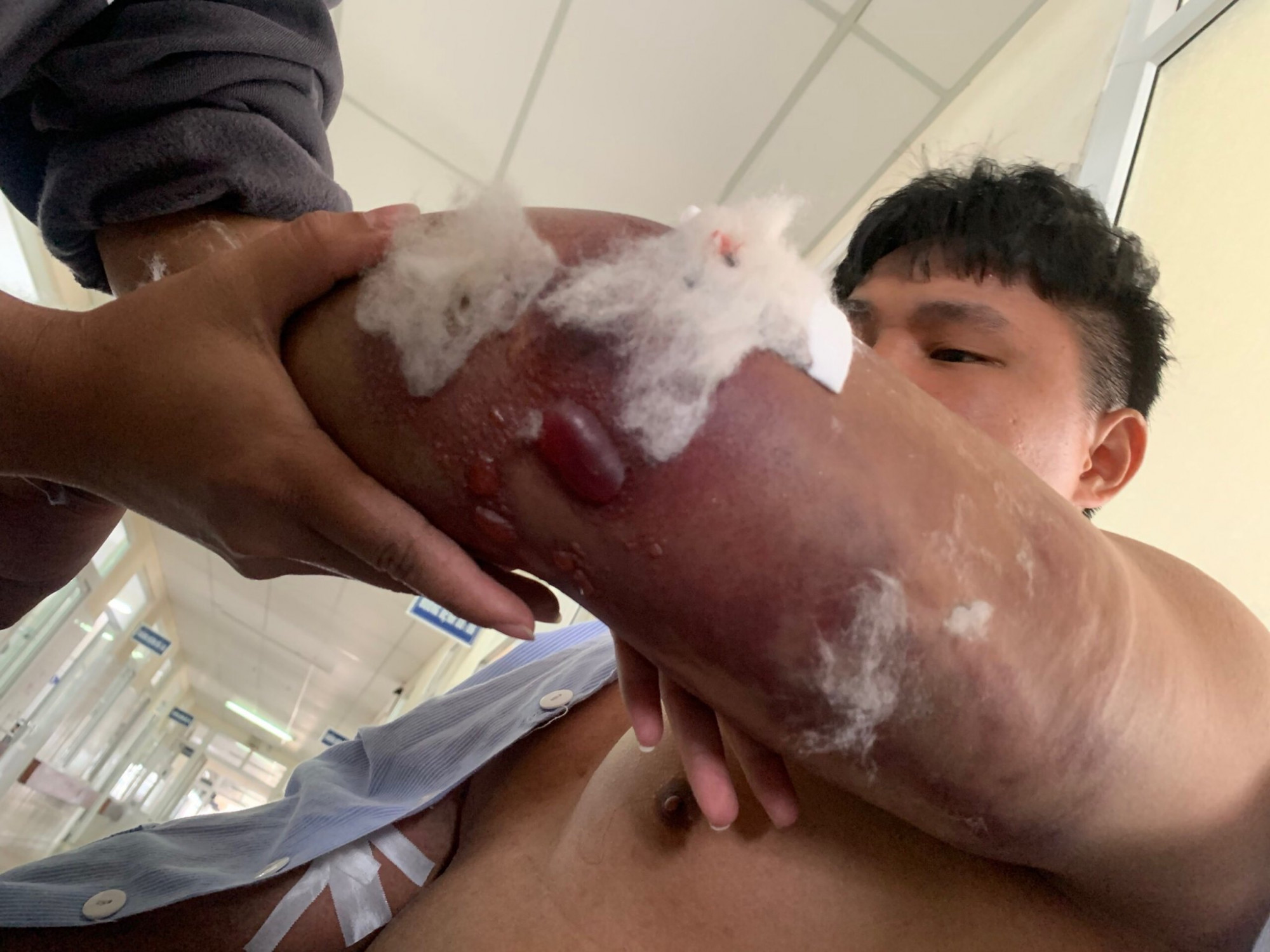 Shipper bị đánh khi giao hàng phải mổ cả 2 tay-1