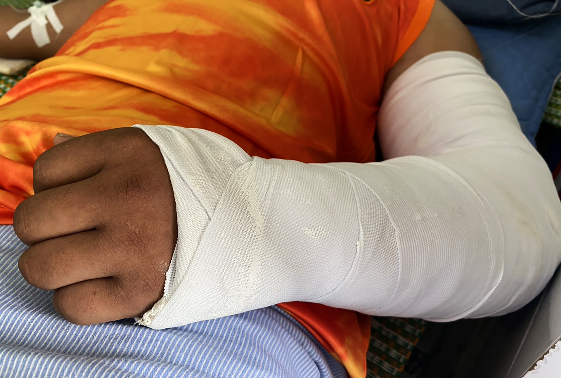 Nam shipper kể lại lúc bị đôi vợ chồng đánh gãy hai tay-2