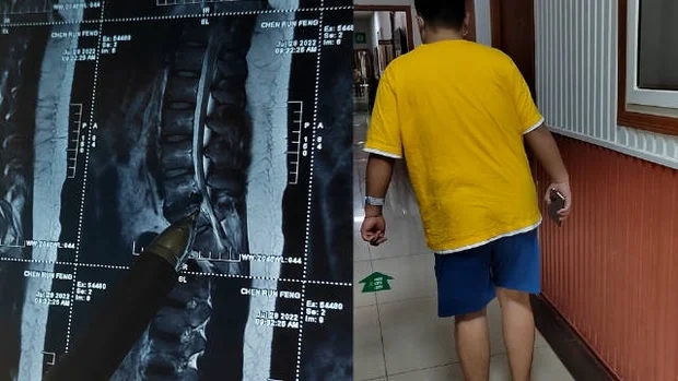 20 tuổi đã bị thoát vị đĩa đệm, 30 tuổi chân không còn cảm giác... bác sĩ cảnh báo thói xấu nên bỏ-1