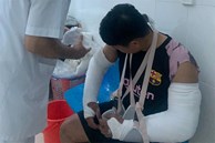 Vụ đánh gãy 2 tay shipper: Do nghi trộm dây chuyền?