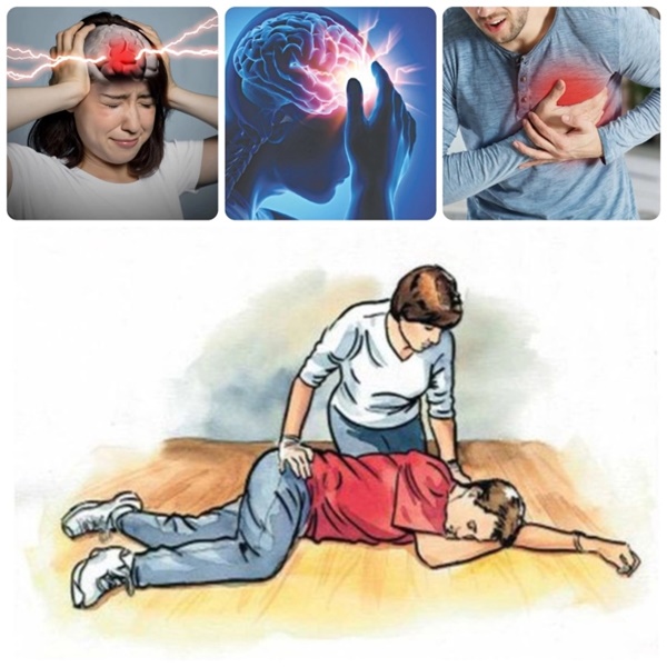 4 dấu hiệu cảnh báo cơn đột quỵ trước 1 tuần, 30 ngày đến vài tháng-1