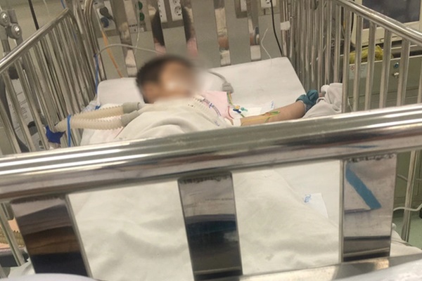 Cứu trẻ bị bỏng nặng đường hô hấp do ngạt khói-1