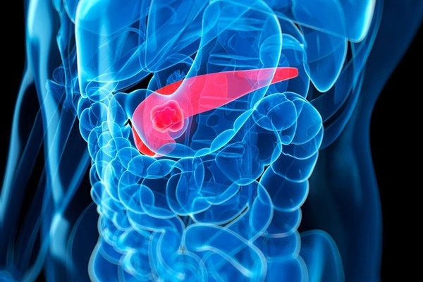 Loại ung thư đang trẻ hóa ở phụ nữ do lối sống hiện đại, 3 dấu hiệu nhận biết để tránh sớm-1