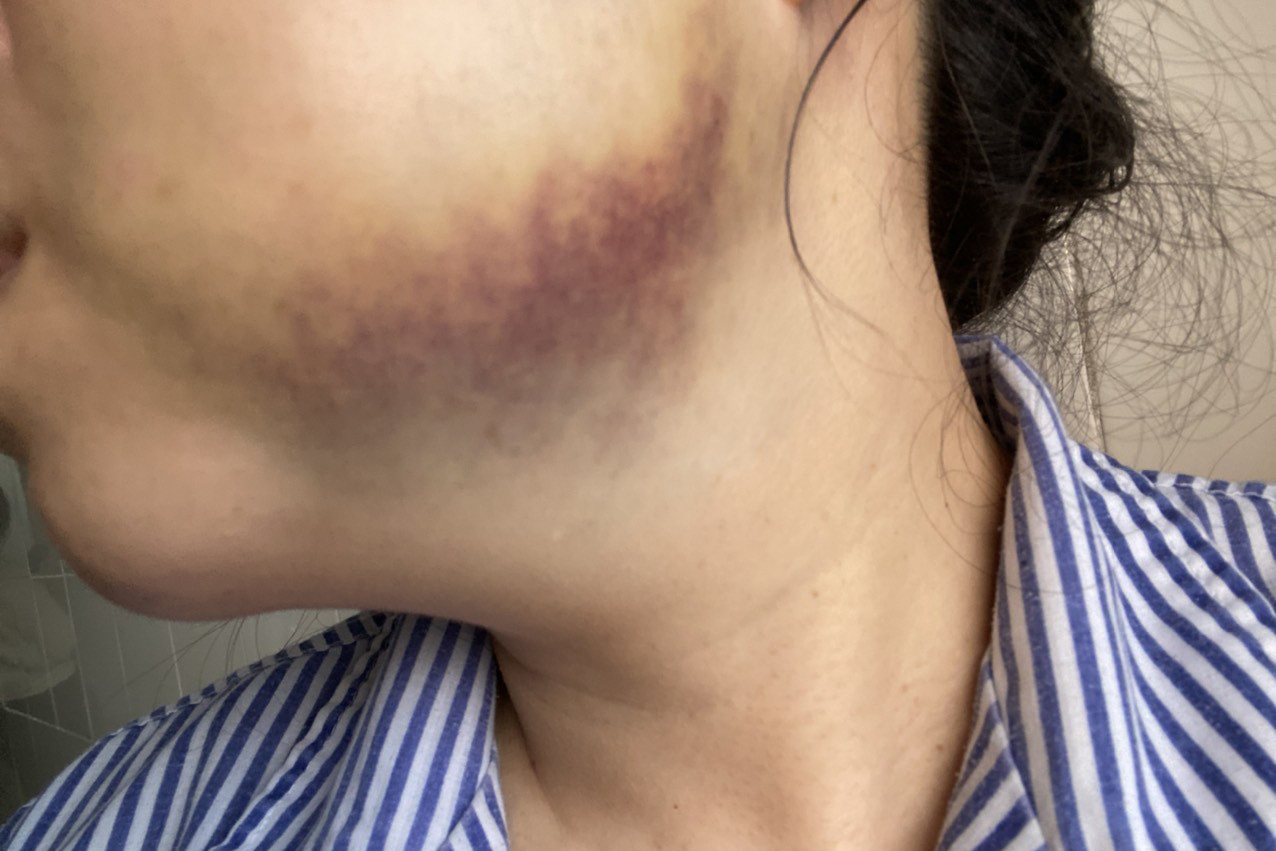 Trưởng phòng công chứng bị người đàn ông đá vào mặt: Tôi bị hành hung nhiều lần-2