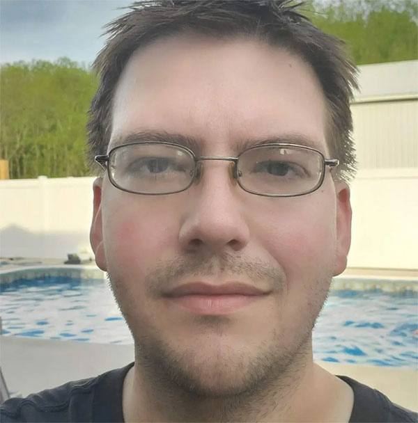 Nỗi khổ cô đơn của người đàn ông có vòng 1 lớn bất thường-2