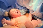 Thai phụ sinh con 2,9kg sau khi bị cành cây đâm thủng tử cung-2