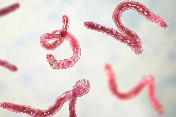 Sán thường ký sinh ở bộ phận nào của con người?-1