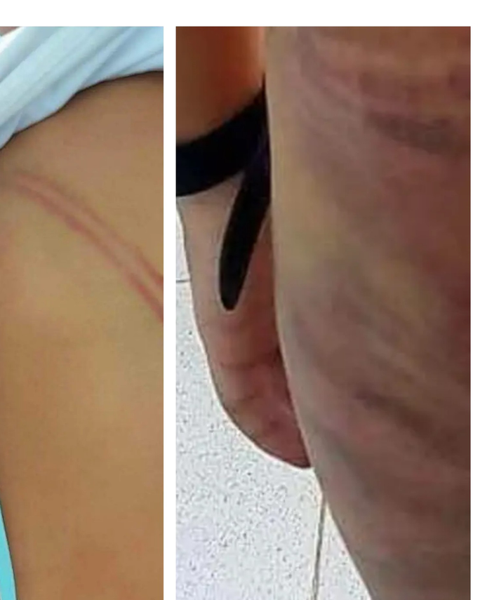 Cà Mau: Bé trai bị mẹ kế đánh bầm tím người vì 20.000 đồng-1