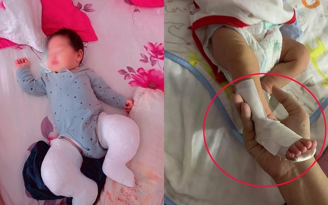 Con bị tật bàn chân khoèo bẩm sinh, mẹ hối hận vì lúc mang bầu ngồi sai tư thế-2