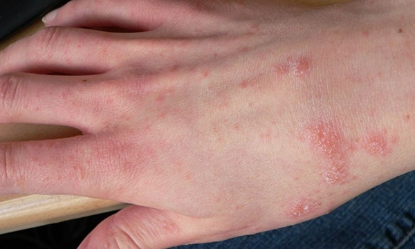 Lợi ích tuyệt vời của rau muống đối với sức khỏe-7