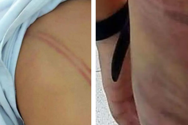 Chủ tịch tỉnh Cà Mau chỉ đạo xử lý nghiêm vụ mẹ kế bạo hành con riêng của chồng-1