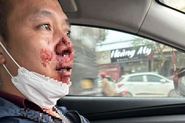 Bắt quả tang 7 cô gái đang bán dâm và kích dục tại cơ sở massage-2