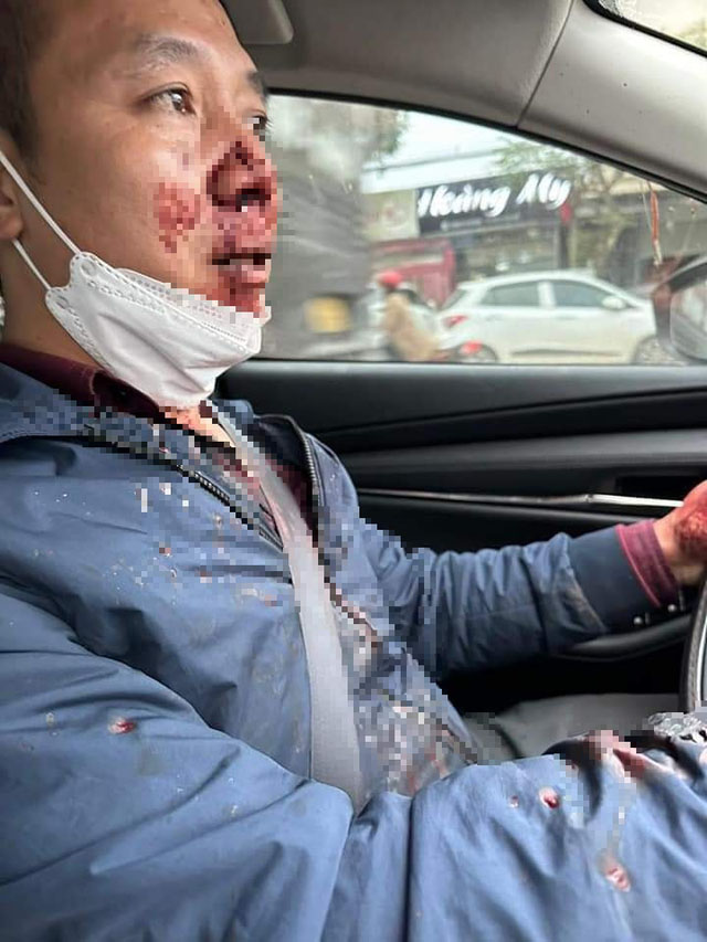 Táo tợn chặn ôtô của thầy giáo cướp tài sản giữa ban ngày-1