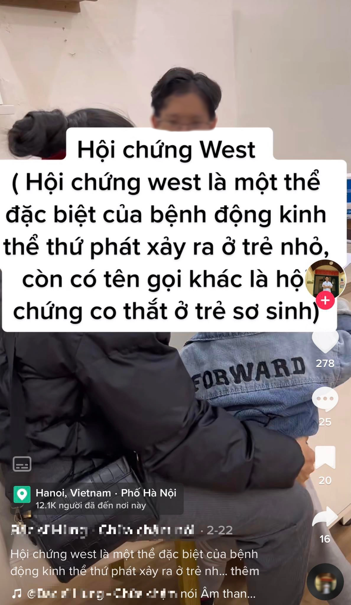 Hội chứng West: Thủ phạm khiến trẻ càng lớn càng chậm phát triển-2