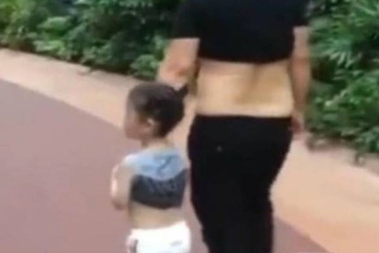Ông bố dắt con gái 4 tuổi đi dạo, nóng quá liền xắn áo lên ngực, hành vi tiếp theo của cô bé khiến dân mạng phải suy ngẫm