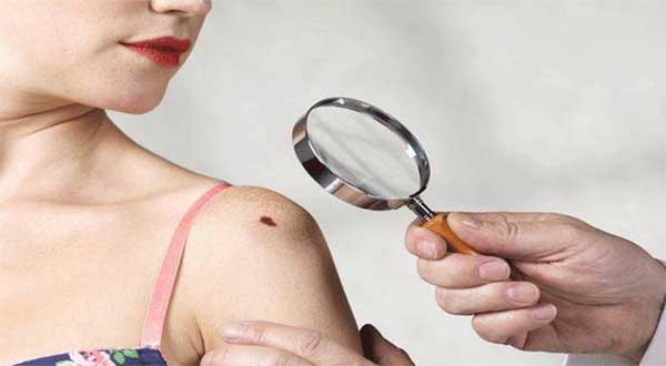 Vị trí nốt ruồi xấu trên cơ thể cho thấy người phụ nữ sẽ vất cả cả đời-3