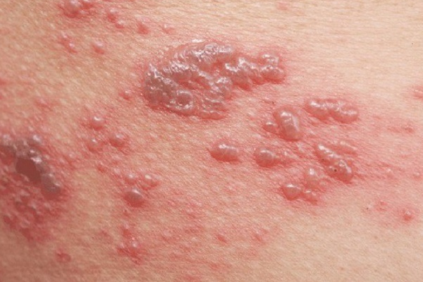 Cùng là tỏi nhưng bên ngoài lại có củ màu tím và củ màu trắng, làm sao để chọn mà không bị mất tiền oan?-5