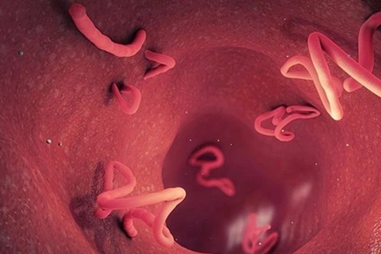 Dấu hiệu cảnh báo bạn nhiễm giun sán