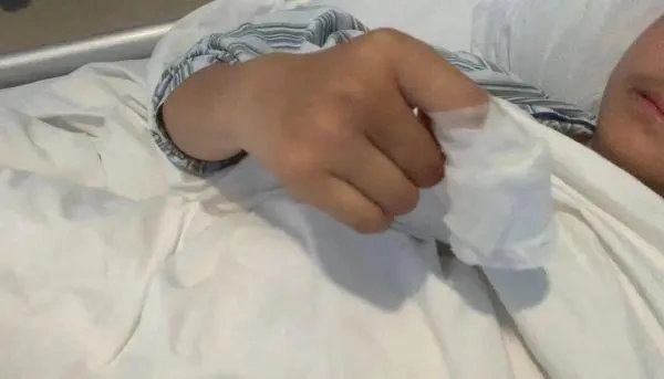 Nam sinh 13 tuổi ngón tay sưng tấy, có nguy cơ phải cắt cụt chi vì thói quen nhiều người làm mỗi khi căng thẳng-2