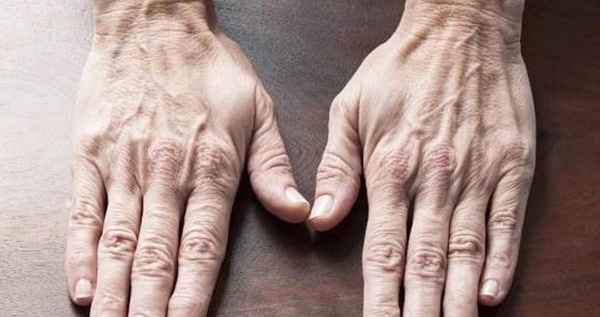 Một bộ phận trên cơ thể nếu mềm thì sẽ sống lâu, cứng có thể dẫn đến bệnh tim mạch, xuất huyết não-2