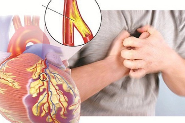 Một bộ phận trên cơ thể nếu mềm thì sẽ sống lâu, cứng có thể dẫn đến bệnh tim mạch, xuất huyết não-4
